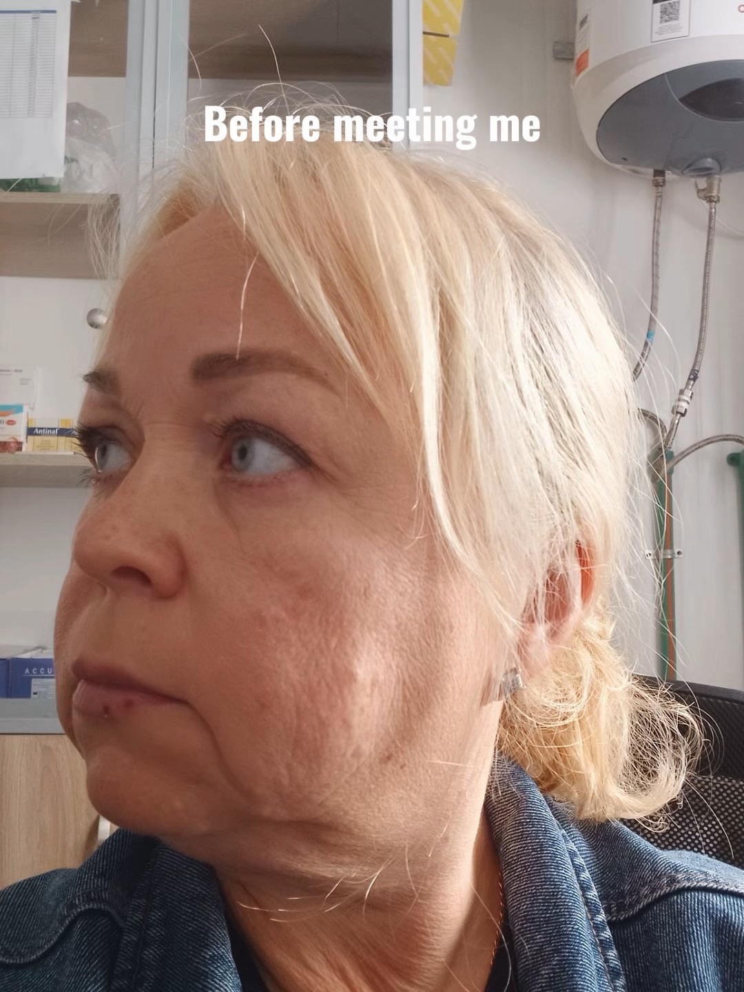 deepplanefacelift
