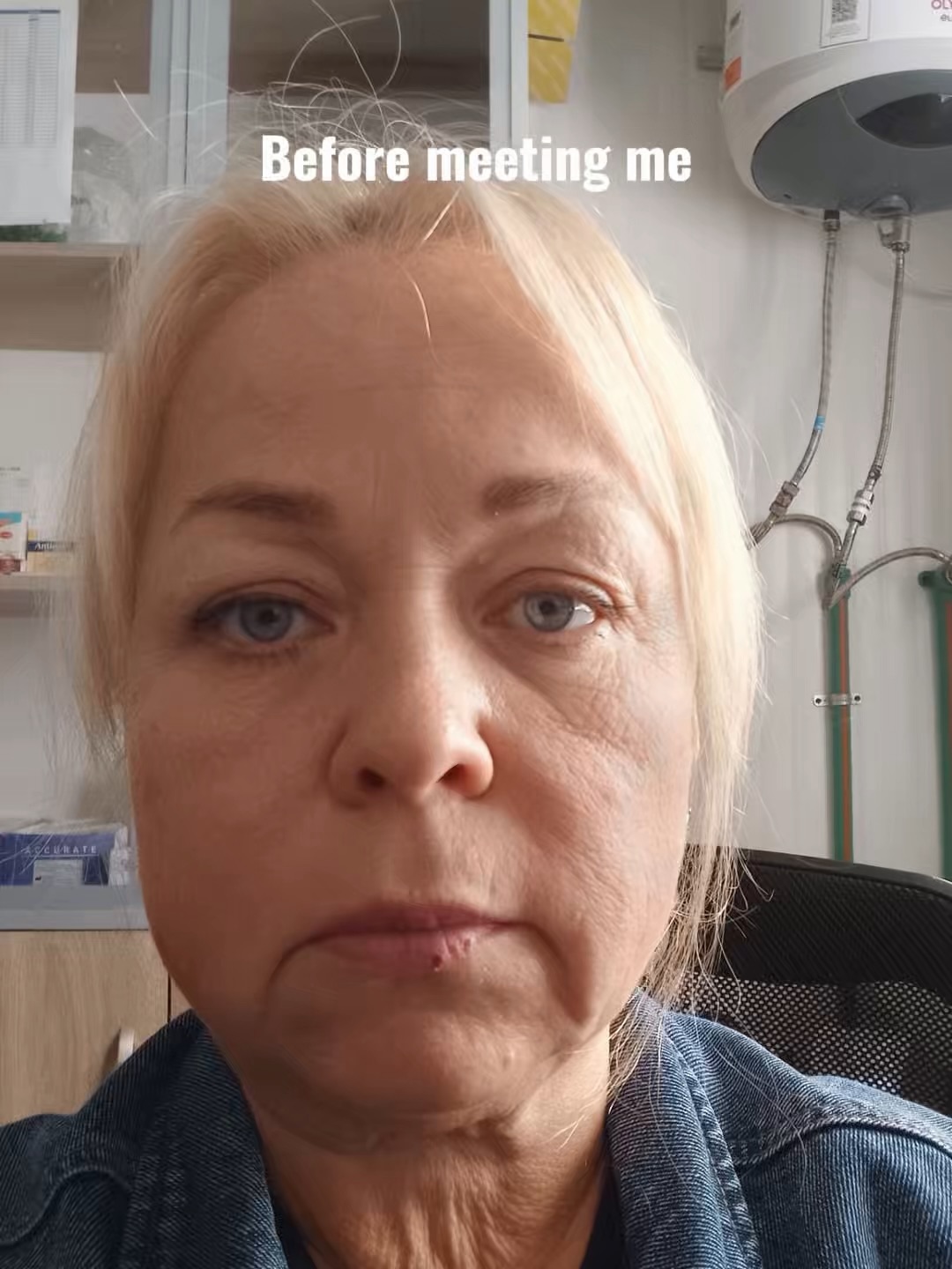 deepplanefacelift