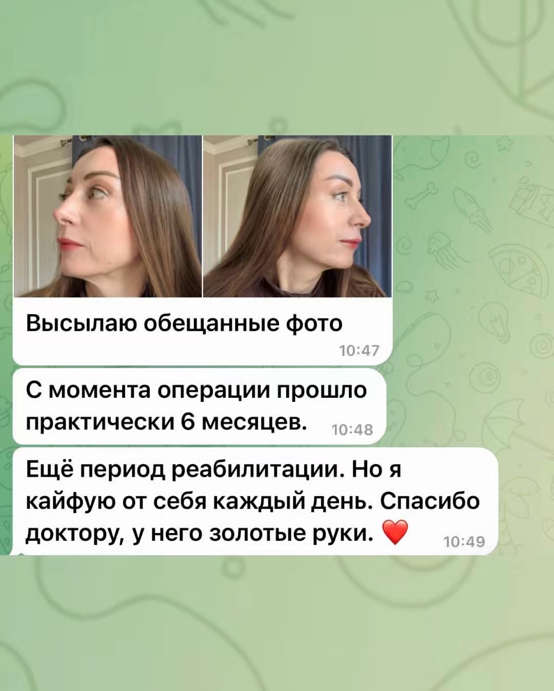эндоскопическийлифтинг
