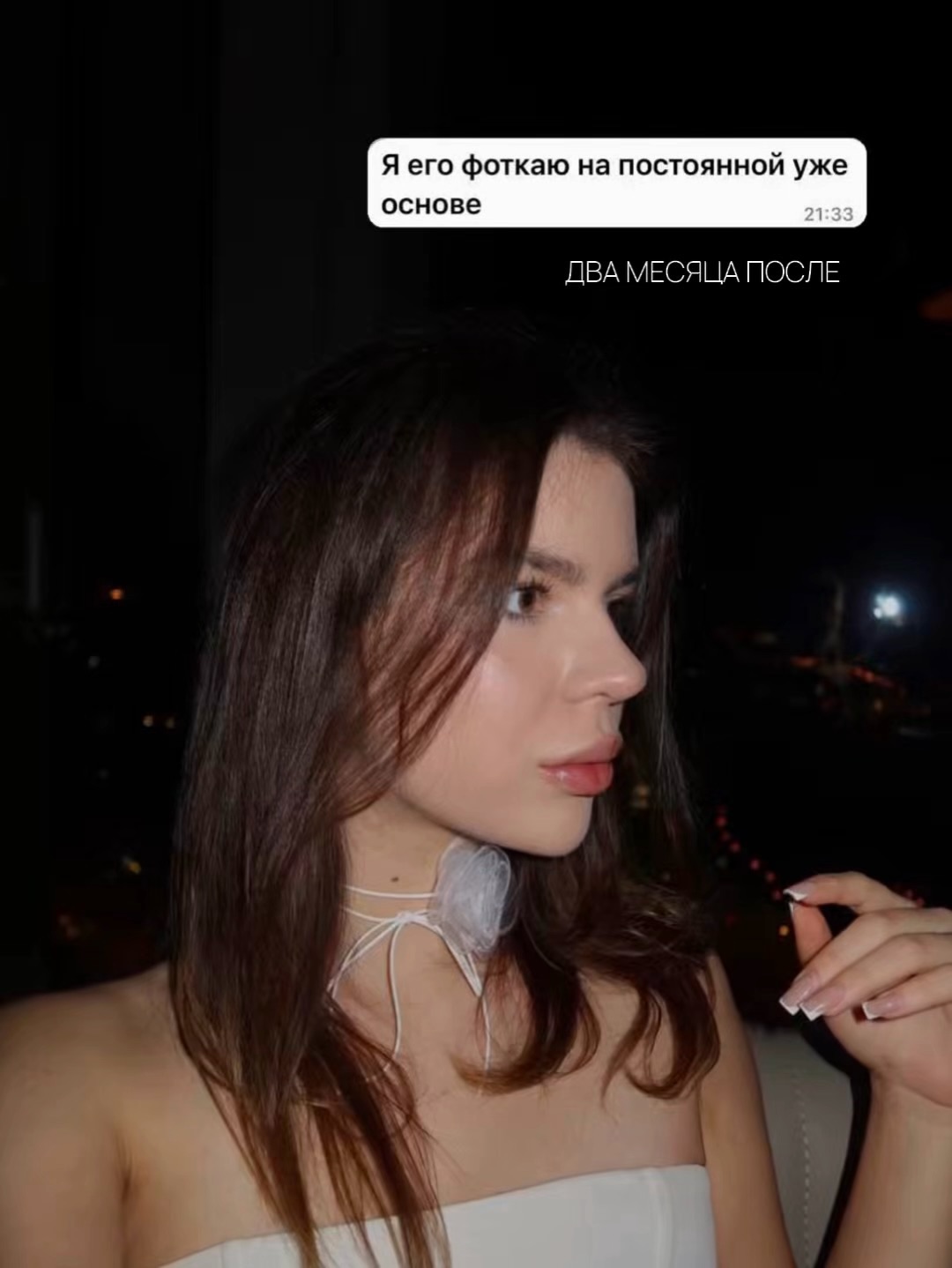 Rhinoplasty